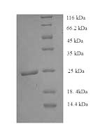 Greater than 90% as determined by SDS-PAGE.Recombinant Human Histone Deacetylase 9 (HDAC9) Protein (His)