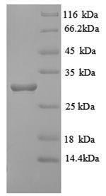 Greater than 90% as determined by SDS-PAGE.Recombinant Human Hla Class Ii Histocompatibility Antigen, Drb1-12 Beta Chain (HLA-DRB1) Protein (His)