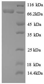 Greater than 90% as determined by SDS-PAGE.Recombinant E.Coli Atp-Dependent Dna Helicase Recq (RECQ) Protein (His)
