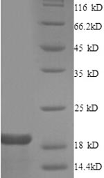 Greater than 90% as determined by SDS-PAGE.Recombinant Human Gap Junction Alpha-1 Protein (GJA1) Protein (His)