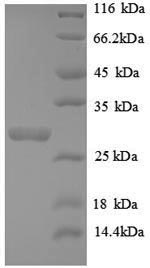 Greater than 90% as determined by SDS-PAGE.Recombinant Human Telomerase Protein Component 1 (TEP1) Protein (His)
