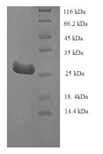 Greater than 90% as determined by SDS-PAGE.Recombinant Human Telomerase Protein Component 1 (TEP1) Protein (His)