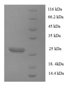 Greater than 90% as determined by SDS-PAGE.