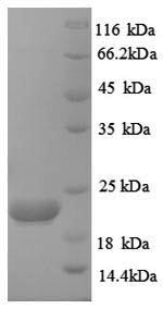 Greater than 90% as determined by SDS-PAGE.Recombinant Human Caspase-8 (CASP8) Protein (His)