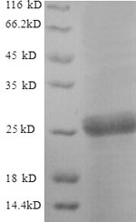 Greater than 90% as determined by SDS-PAGE.Recombinant Saccharomyces Cerevisiae Neutral Trehalase (NTH1) Protein (His)