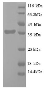 Greater than 90% as determined by SDS-PAGE.Recombinant Avian Infectious Bursal Disease Virus Structural Polyprotein (PP) Protein (His)