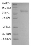 Greater than 90% as determined by SDS-PAGE.Recombinant Infectious Bronchitis Virus Spike Glycoprotein S1 Subunit (S1) Protein (GST)