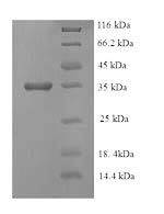 Greater than 90% as determined by SDS-PAGE.Recombinant E.Coli Ethanolamine Ammonia-Lyase Light Chain (EUTC) Protein (His)