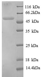 Greater than 90% as determined by SDS-PAGE.Recombinant Chicken Tubulin Beta-1 Chain Protein (His)