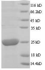 Greater than 90% as determined by SDS-PAGE.Recombinant Human Cytomegalovirus Cytoplasmic Envelopment Protein 3 (UL99) Protein (His)