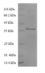 Greater than 90% as determined by SDS-PAGE.