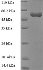 Greater than 90% as determined by SDS-PAGE.Recombinant E.Coli Purine Nucleoside Phosphorylase Deod-Type (DEOD) Protein (GST)