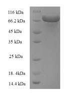 Greater than 90% as determined by SDS-PAGE.Recombinant E.Coli Glucose-6-Phosphate 1-Dehydrogenase (ZWF) Protein (GST)