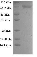 Greater than 90% as determined by SDS-PAGE.Recombinant Hepatitis C Genome Polyprotein Protein (His)