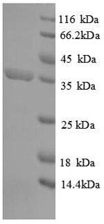 Greater than 90% as determined by SDS-PAGE.Recombinant E.Coli 4-Hydroxy-Tetrahydrodipicolinate Synthase (DAPA) Protein (His)