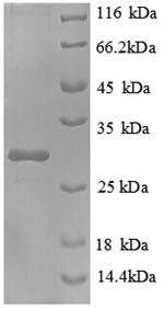 Greater than 90% as determined by SDS-PAGE.Recombinant E.coli NAD (FRE) Protein (His)