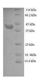 Greater than 90% as determined by SDS-PAGE.Recombinant Leuconostoc Mesenteroides Subsp. Cremoris D-Lactate Dehydrogenase (D-LDH) Protein (His)