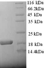 Greater than 90% as determined by SDS-PAGE.Recombinant Rat Alpha-2-Macroglobulin (A2M) Protein (His)