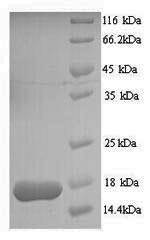Greater than 90% as determined by SDS-PAGE.Recombinant Entamoeba Histolytica Multidrug Resistance Protein 1 (MDR1) Protein (His)