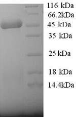 Greater than 90% as determined by SDS-PAGE.Recombinant Human 3-Ketoacyl-Coa Thiolase, Mitochondrial (ACAA2) Protein (His)