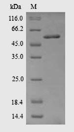 Greater than 90% as determined by SDS-PAGE.Recombinant Rat Acetyl-Coa Carboxylase 1 (ACACA) Protein (His)