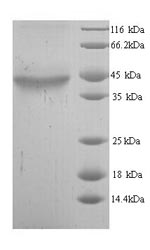 Greater than 90% as determined by SDS-PAGE.Recombinant Human Alcohol Dehydrogenase Class-3 (ADH5) Protein (His)