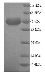 Greater than 90% as determined by SDS-PAGE.Recombinant Human All-trans-retinol dehydrogenase [NAD (ADH7) Protein (His)