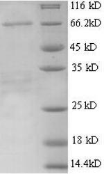 Greater than 90% as determined by SDS-PAGE.Recombinant Mouse Alpha-Fetoprotein (AFP) Protein (His)