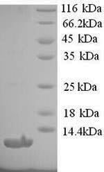 Greater than 90% as determined by SDS-PAGE.Recombinant Human Type-1 Angiotensin Ii Receptor (AGTR1) Protein (His)