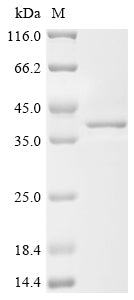 Greater than 85% as determined by SDS-PAGE.Recombinant Mouse Single-Stranded Dna Cytosine Deaminase (AICDA) Protein (His)