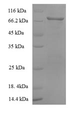 Greater than 90% as determined by SDS-PAGE.Recombinant Cynomolgus Monkey Albumin (ALB) Protein (His)