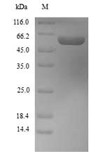 Greater than 90% as determined by SDS-PAGE.Recombinant Mouse Aldehyde Dehydrogenase 1A1 (ALDH1A1) Protein (His)