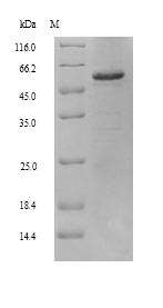 Greater than 90% as determined by SDS-PAGE.Recombinant Human Retinal Dehydrogenase 2 (ALDH1A2) Protein (His)