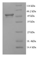 Greater than 90% as determined by SDS-PAGE.Recombinant Human Succinate-Semialdehyde Dehydrogenase, Mitochondrial (ALDH5A1) Protein (His)