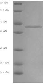 Greater than 90% as determined by SDS-PAGE.Recombinant Rabbit Fructose-Bisphosphate Aldolase B (ALDOB) Protein (His)