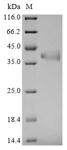 Greater than 90% as determined by SDS-PAGE.Recombinant Mouse Fructose-Bisphosphate Aldolase C (ALDOC) Protein (His)