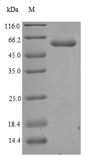 Greater than 90% as determined by SDS-PAGE.Recombinant Human Angiopoietin-2 (ANGPT2) Protein (His)