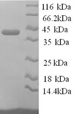 Greater than 90% as determined by SDS-PAGE.Recombinant Mouse Annexin A1 (ANXA1) Protein (His)