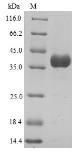 Greater than 90% as determined by SDS-PAGE.Recombinant Human Annexin A3 (ANXA3) Protein (His)