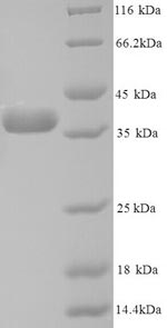 Greater than 90% as determined by SDS-PAGE.Recombinant Human Annexin A5 (ANXA5) Protein (His)