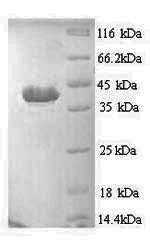 Greater than 90% as determined by SDS-PAGE.Recombinant Human Apoptotic Protease-Activating Factor 1 (APAF1) Protein (His)