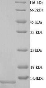 Greater than 90% as determined by SDS-PAGE.Recombinant Human Apolipoprotein C-Ii (APOC2) Protein (His)