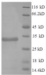 Greater than 90% as determined by SDS-PAGE.Recombinant Mouse Apolipoprotein E (APOE) Protein (His)