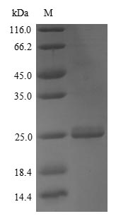 Greater than 90% as determined by SDS-PAGE.Recombinant Mouse Apolipoprotein M (APOM) Protein (His)