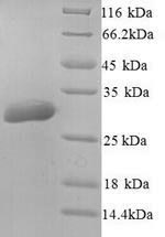 Greater than 90% as determined by SDS-PAGE.Recombinant Human Aquaporin-5 (AQP5) Protein (His)