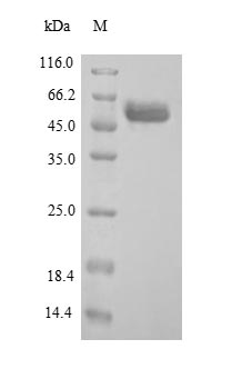 Greater than 90% as determined by SDS-PAGE.Recombinant Human Arylsulfatase B (ARSB) Protein (His)
