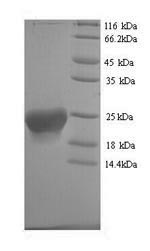 Greater than 90% as determined by SDS-PAGE.Recombinant Human Putative Inactive Neutral Ceramidase B (ASAH2B) Protein (His)