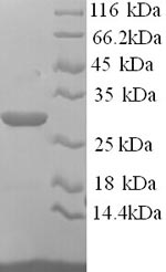 Greater than 90% as determined by SDS-PAGE.Recombinant Mouse Asialoglycoprotein Receptor 1 (ASGR1) Protein (His)