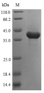Greater than 85% as determined by SDS-PAGE.Recombinant Human Aspartoacylase (ASPA) Protein (His&Myc)