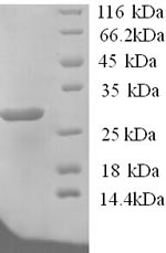 Greater than 90% as determined by SDS-PAGE.Recombinant Human Potassium-Transporting Atpase Subunit Beta (ATP4B) Protein (His)